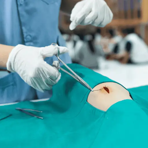 Step-by-step suture removal technique